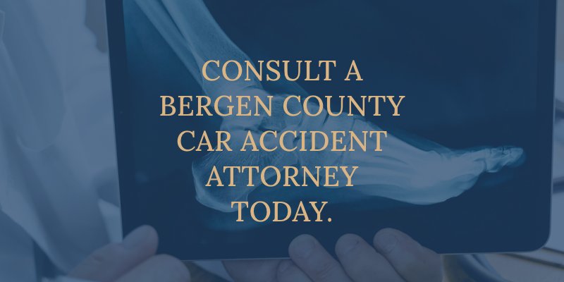bergen county car accident attorney